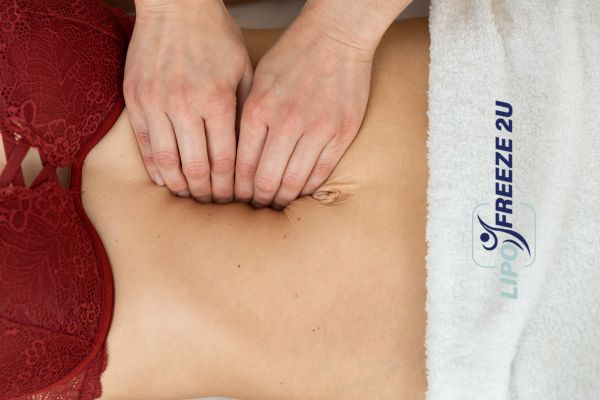 diastasis recti treatment Wilmslow