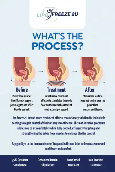 Diagram of how incontinence treatment Wilmslow works.