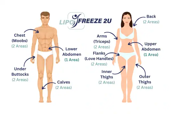 Areas you can have fat freezing treatment Wilmslow