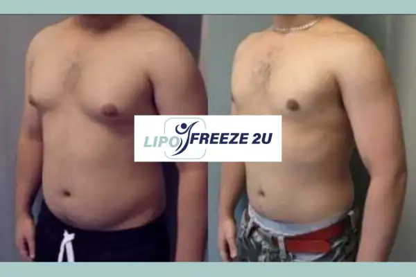 How Long Does It Take to See Results Wilmslow?