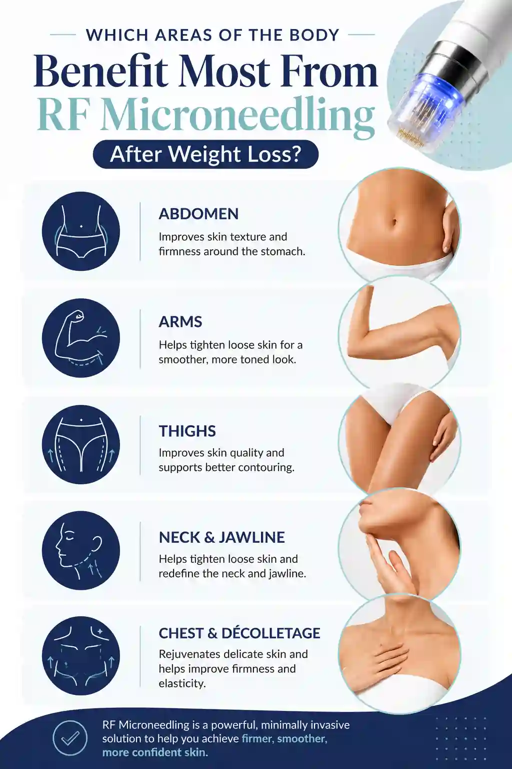 Which Areas of the Body Benefit Most From RF Microneedling After Weight Loss Wilmslow